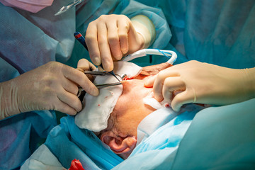Plastic surgery in operating room