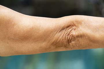 Senior woman raising her arm and elbow on swimming pool background, Body concept, Close up