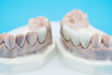 Crown and bridge equipment and model express fix restoration.