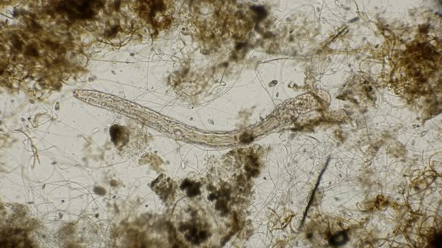 worm of the family Aeolosomatidae, Aeolosoma hemprichi, under the microscope
