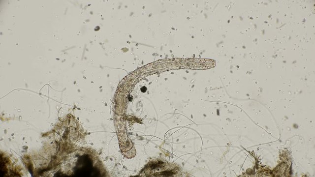 worm of the family Aeolosomatidae, Aeolosoma hemprichi, under the microscope