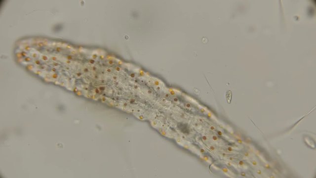 worm of the family Aeolosomatidae, Aeolosoma hemprichi, under the microscope