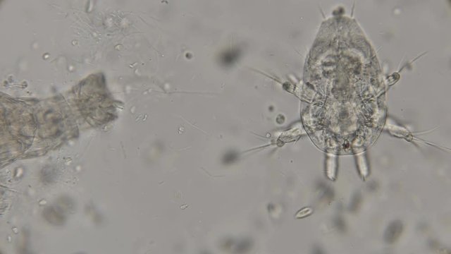 Rotifera philodina and near nauplius Cyclops under a microscope