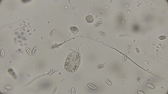 a large colony of various protozoa under a microscope