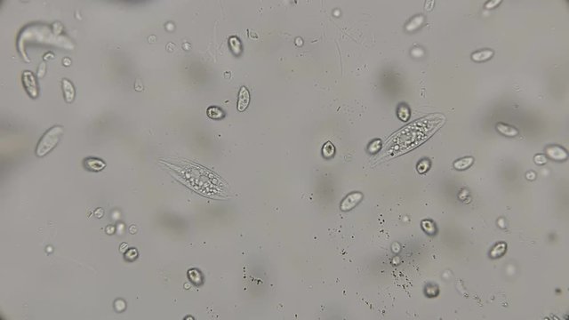 a large colony of various protozoa under a microscope