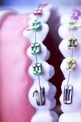 Dental metal brace teeth model