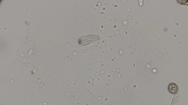 the movement of ciliary infusoria and other micro-organisms under a microscope