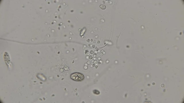 a large colony of various protozoa under a microscope