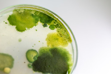 Backgrounds of Colony Characteristics of Fungus and algae in petri dish for education.