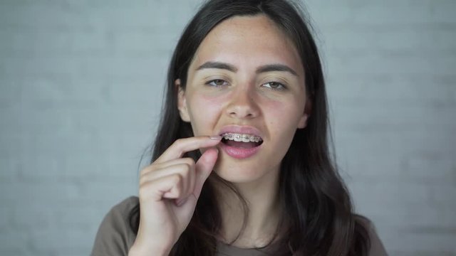 the girl wears braces on her teeth. discomfort, pain