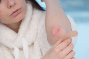 Woman using adhesive tape on hand.