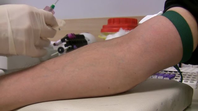 Close up view of nurse hands collecting blood specimen or sample from patient's vein in medical laboratory.Blood flowing into the tube, tubes rotating in rotator in the background