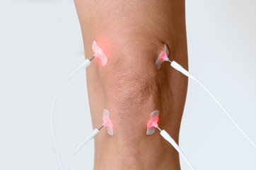 Patient having electrode therapy on a knee joint
