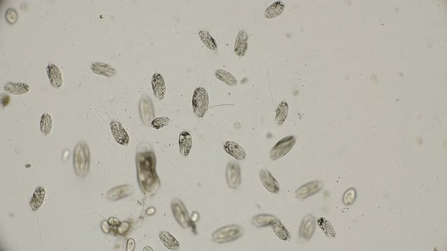 a colony of ciliates Stylonychia under the microscope