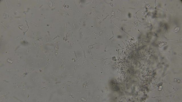 a drop of dirty water with bacteria: spirochaetes, rod-shaped bacteria, bacilli and others, under the microscope