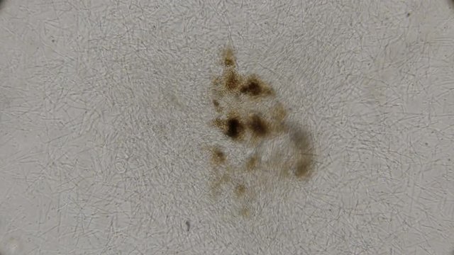 colony of spirochete, rod-shaped bacteria and other bacteria living in dirty, rotten water, under a microscope