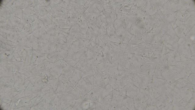colony of spirochete, rod-shaped bacteria and other bacteria living in dirty, rotten water, under a microscope