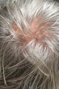 Graue Haare mit Tonsur