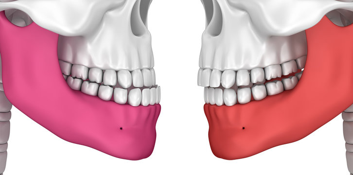 Occlusion: Overjet and Overbite, 3D illustration .
