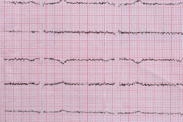 Close up of cardiogram used as background, medical theme