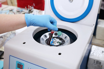 Medical centrifuge for plasma lifting - obrazy, fototapety, plakaty