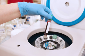 Tube of blood is placed in a centrifuge for plasma lifting - obrazy, fototapety, plakaty