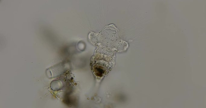 rotifer is kind of like a genus of Collotheca ornata, under a microscope