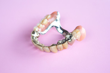 closeup of dental prosthesis on pink background
