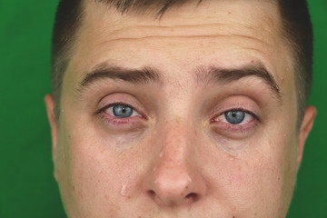 Fototapeta premium Tears in eyes of crying adult man. Green background. Chromakey