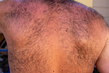 Hairy men back 