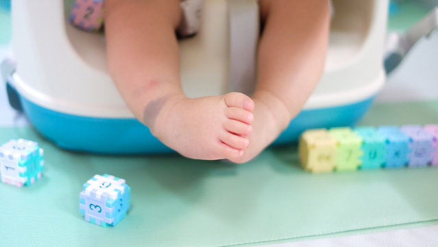 The Little Feet Of Baby Sitting On The Chair With Spot Look Like Stigma (Called 