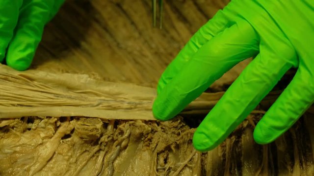 Closeup shot of the inside of a formaldehyde body in 4K