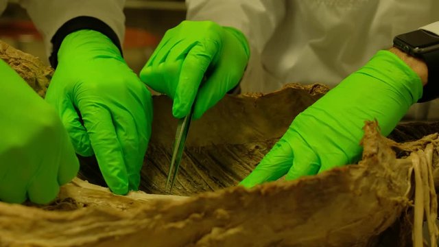 Closeup shot of specialists examining a formaldehyde body in 4K