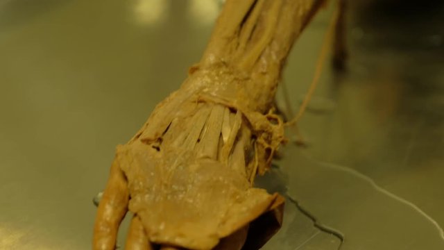 Closeup shot of a formaldehyde arm in 4K