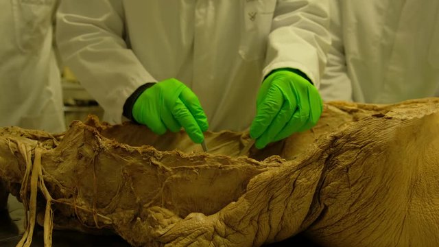 Closeup shot of two specialists examining a formaldehyde body in a clinical environment in 4K