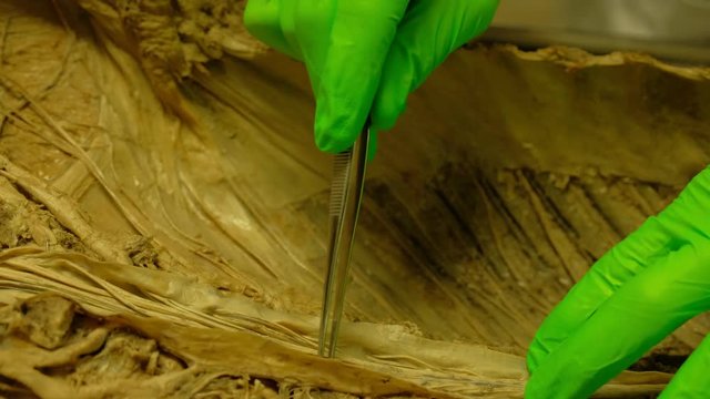Closeup shot of two specialists pointing out parts inside a formaldehyde body in 4K