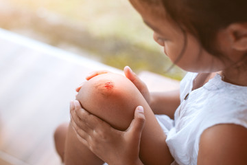 Fresh wound and blood from injured on child knee after she has been an accident