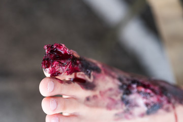 Fake wound.on foot, wound makeup special effect, selective focus, abstract blur background, shallow...