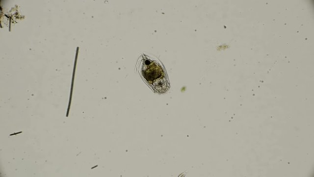 rotifer Epiphanes senta under a microscope