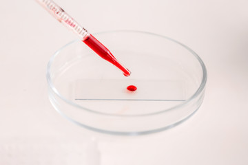 Working with blood sample in laboratory, closeup
