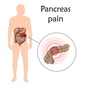 Pancreas Pain Location