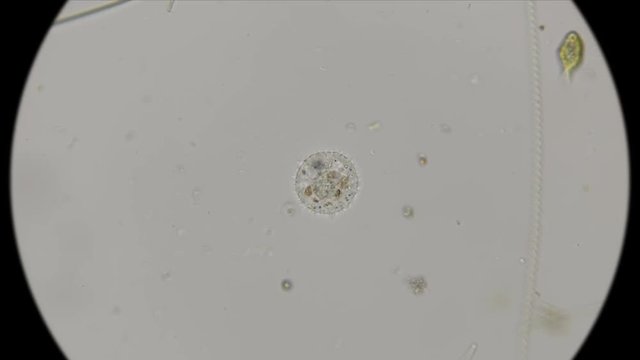 Testate amoeba under a microscope