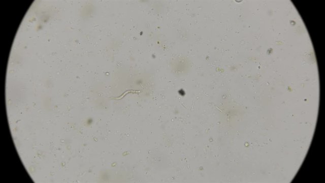 spiral, curved bacterium, a parasite ,under the microscope
