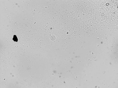 Photomicroscopy of activated sludge from the bacterial wastewater treatment zone