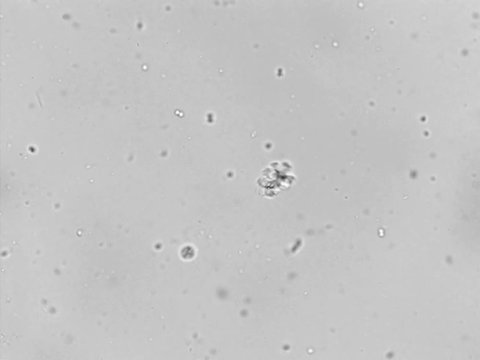 Photomicroscopy of activated sludge from the bacterial wastewater treatment zone