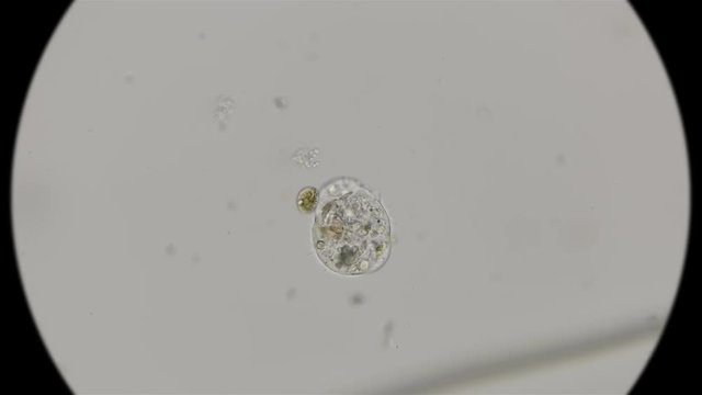 Defecation, Endocytosis (excretion) in Testate amoeba, under a microscope