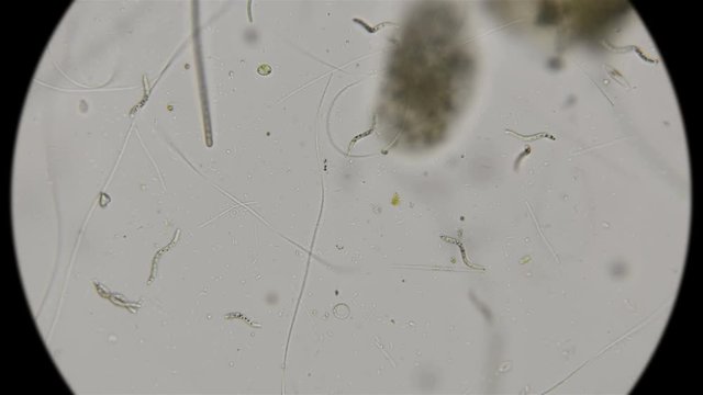 spiral, curved bacterium, a parasite ,under the microscope