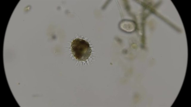 Testate amoeba under a microscope