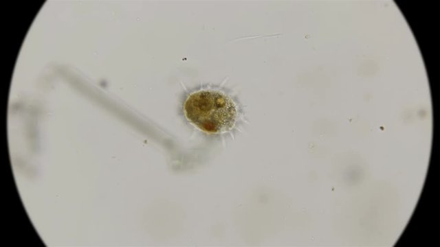 Testate amoeba under a microscope