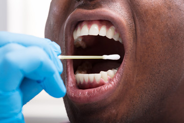Dentist Cleaning Teeth With Cotton Buds